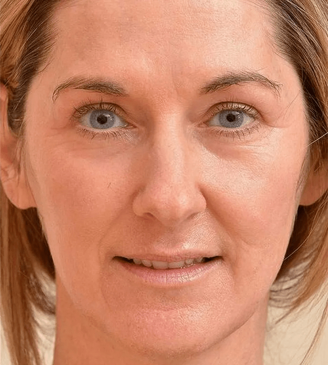 Sembro più giovane dopo aver applicato la crema Eudalie