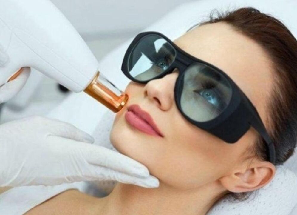 Ringiovanimento del viso della pelle